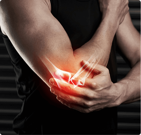 Elbow Pain - Lederman Kwartowitz Orthopedics & Sports Medicine