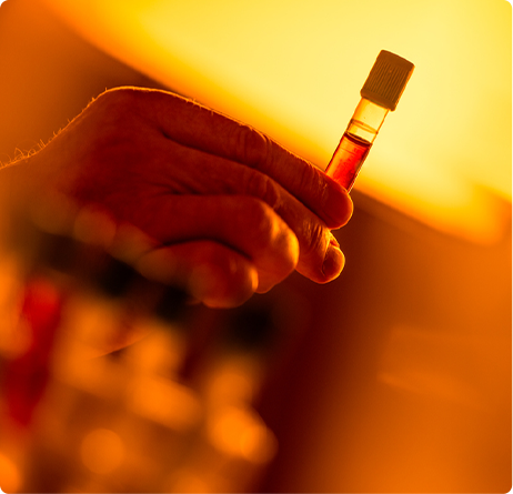 sports medicine doctor - Platelet Rich Plasma - PRP Treatments West Bloomfield, MI - prp therapy - lederman kwartowitz orthopedics -