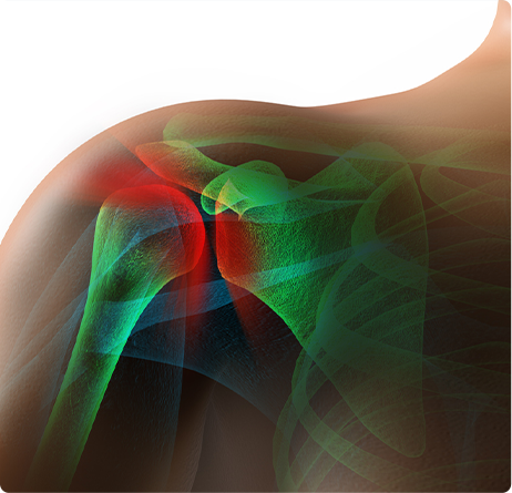 Rotator Cuff - Shoulder Pain - Shoulder Surgery West Bloomfield, MI